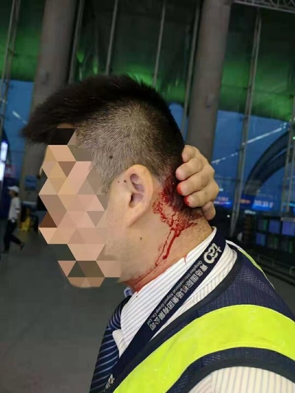 醉酒旅客毆打機場工作人員 被處以拘留與(yu) 經濟處罰