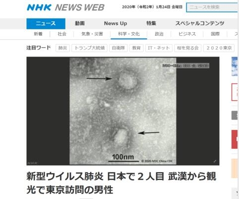 日本發現第二例新型肺炎確診病例 患者係武漢遊客